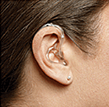 Comprar aparelho auditivo: Aparelho Retroauricular (BTE — Behind-the-Ear)